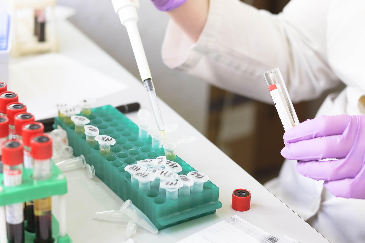 Advanced Research Methods — Laboratory, medical, medicine, hand, research, lab, test, doctor, equipment, scientist, woman, chemistry, science, hospital, experiment, person, technician, technology, healthcare, working, health, tube, work, research lab, blood samples, laboratory, lab, lab, scientist, scientist, scientist, scientist, scientist