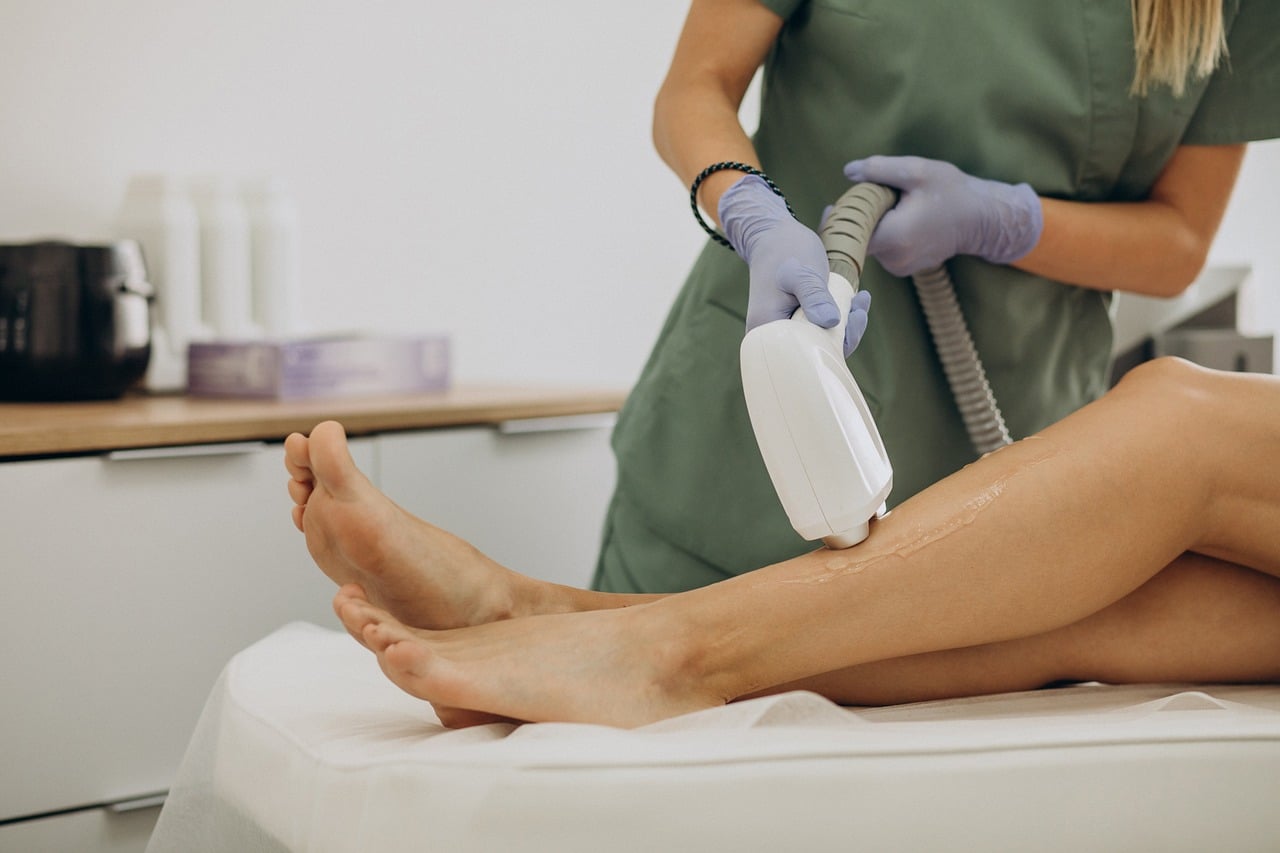 Epilation — Depilation laser, beauty treatment, laser hair removal, epilator, hairless, cosmetic, skincare, laser epilation
